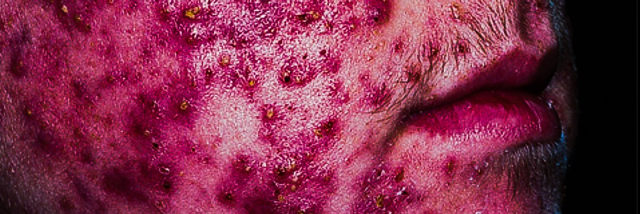 Cover image for post Character Assassination, by Yowwa