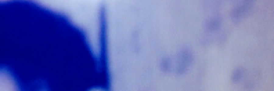 Cover image for post It's Curtains!, by Rafaelopezjr