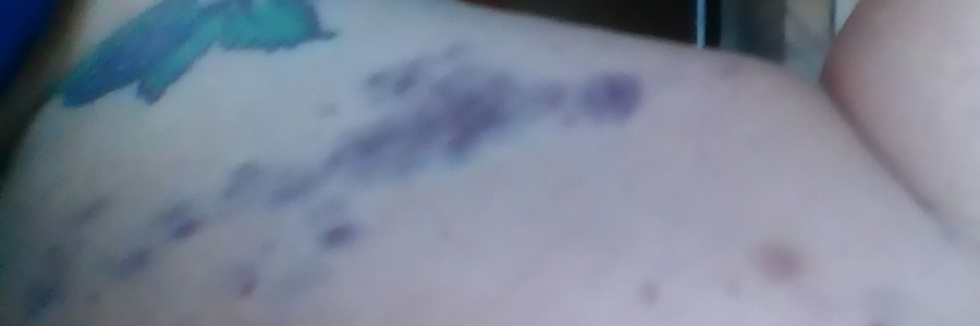 Cover image for post Life Hurts Like Hell, by RikkiSage