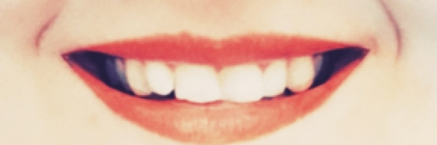 Cover image for post High Hat, by SE