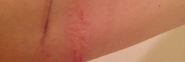 Cover image for post Instruments have stopped cutting, by Rebecca93