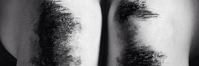 Cover image for post The Process of Healing, by Leftyguitarist9