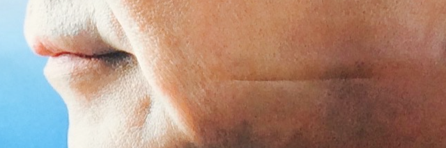 Cover image for post xWHO, by modteis