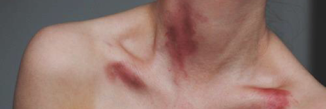 Cover image for post ardor marks, by paintingskies