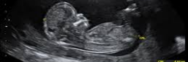 Cover image for post Every single day, by InfiniteStarr