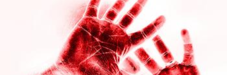 Cover image for post Unclean Hands, by sandflea68