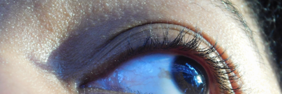 Cover image for post Dilemma, by LexiCon