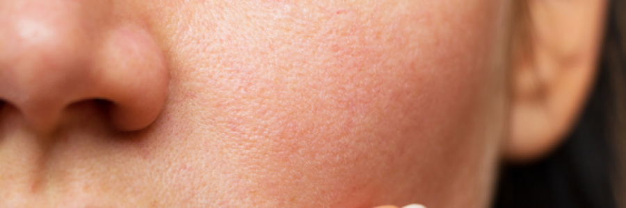 Cover image for post Her skin, by tate