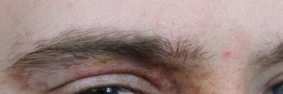 Cover image for post Feel tested yet?, by East