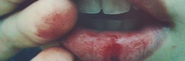 Cover image for post Lump in my throat, by Jesuisamanda