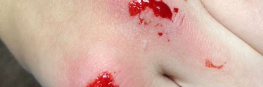 Cover image for post Poison, by LateNightLover