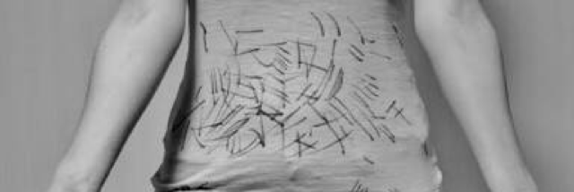 Cover image for post trypophobia, by galaxyy