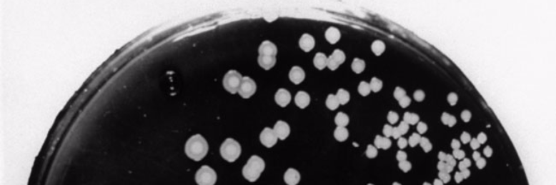 Cover image for post Petri Dish, by themanmoth