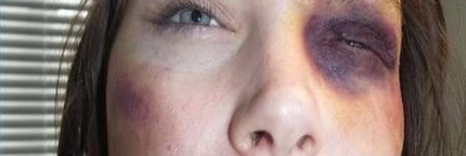 Cover image for post Untitled, by Vyxyn