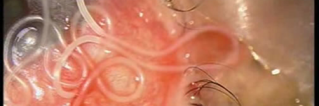 Cover image for post Guilty Vomit, by LillyZ