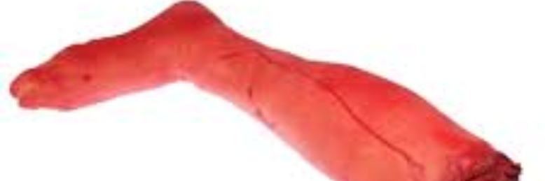 Cover image for post The Victim, by sandflea68