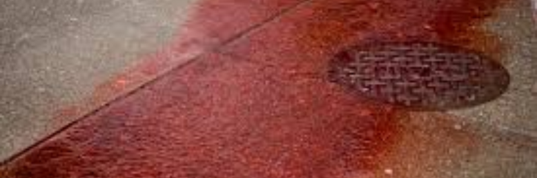 Cover image for post I Didn't See It Coming, by sandflea68