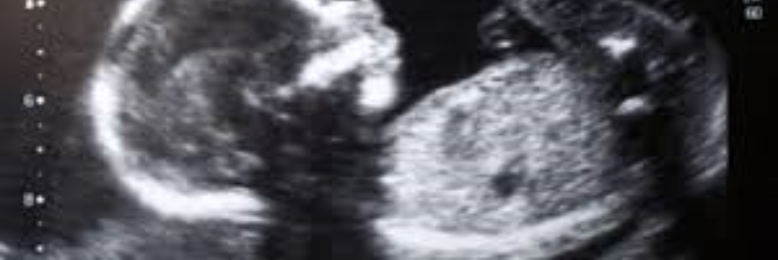 Cover image for post Unheard Cries, by sandflea68