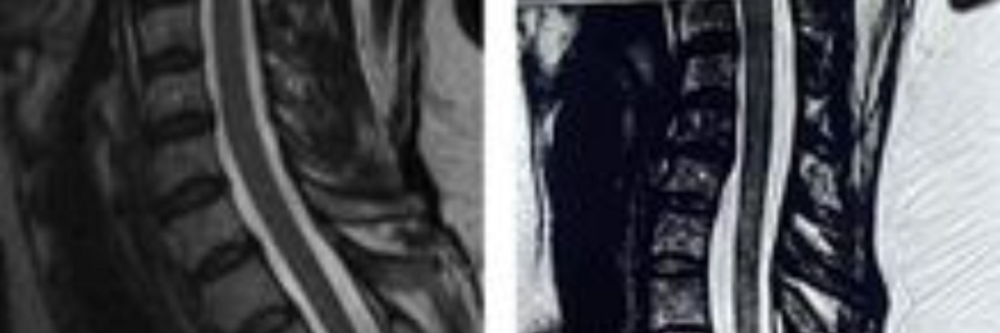 Cover image for post Macabre at best., by Plexiglassfruit