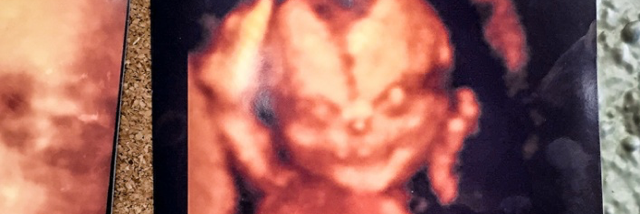 Cover image for post The Birth of Bad Baby (another prequel), by YAngeL