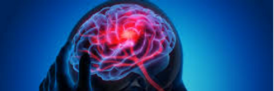 Cover image for post Headaches , by sproductionsinc