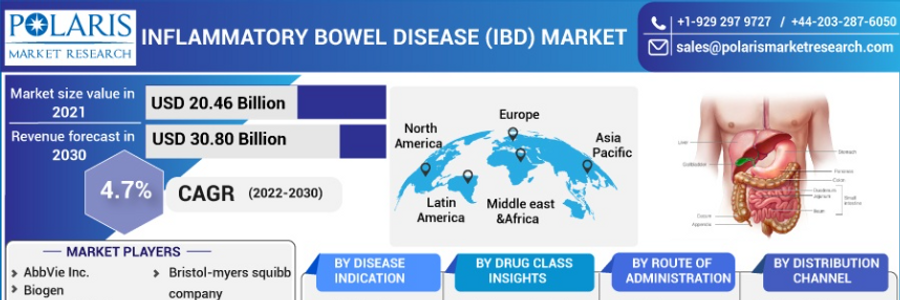 Cover image for post Inflammatory Bowel Disease (Ibd) Market by Technology, Application & Geography – Analysis & Forecast 2023-2032
, by leeortega