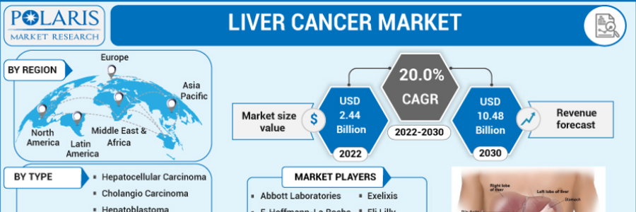 Cover image for post Liver Cancer Market 2023 – Industry Analysis, Size, Share, Strategies and Forecast to 2032
, by leeortega