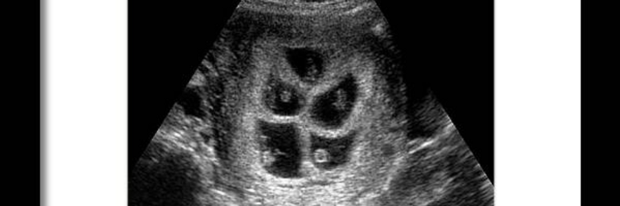 Cover image for post Simple Arithmetic, by GerardDiLeo