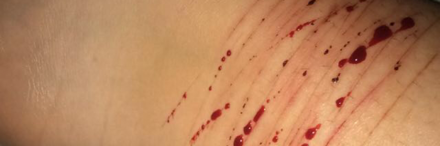 Cover image for post Untitled, by Makyla