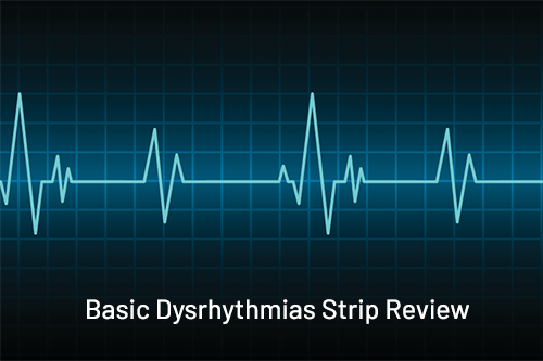 Basic Dysrhythmias
