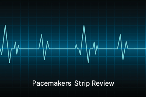 Pacemakers