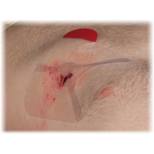 HYFIN Chest Seals Twin Pack