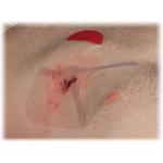 HYFIN Chest Seals Twin Pack