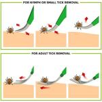 TickCheck Premium Tick Remover Kit