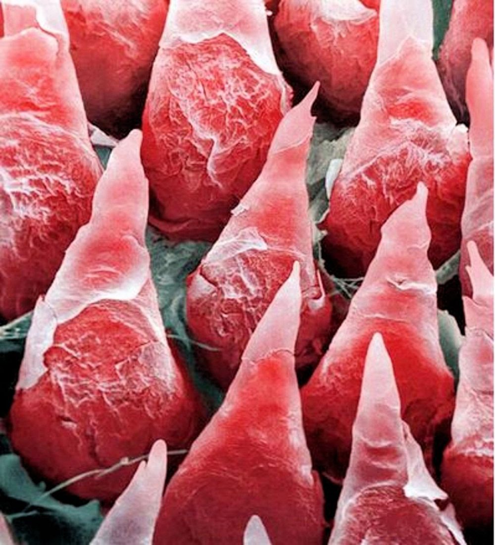 This is what a human tongue looks like under a microscope.