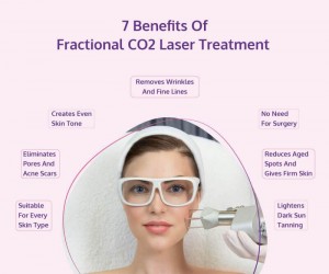 laser pexel