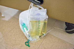 Help a Filipino Teacher GoGetFunding for Surgery