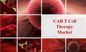 CAR T Cell Therapy