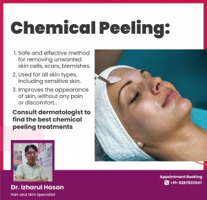 chemical peel 4