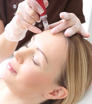 mesotherapy for face