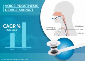 Voice Prosthesis Devices Market