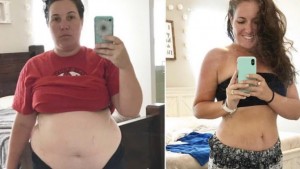 Before And After Anna