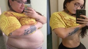 Before And After Kim