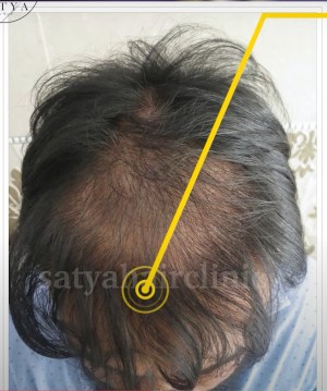 Satya Hair Solutions