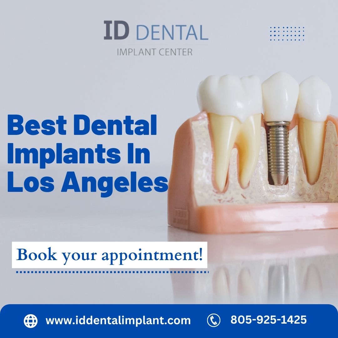 How ID Dental and Implant Center Uses the Latest Technologies and