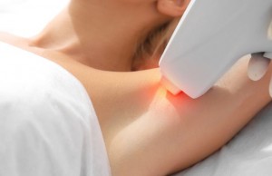 laser hair removal vs waxing hair removal