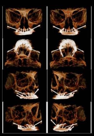 When Destiny Brought A Smile To This Iraqi Boyʼs Face - Dr Rohit Yadav