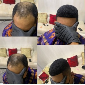 African Men Unit