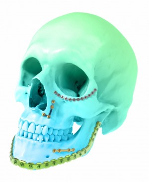 Maxillofascial Implants