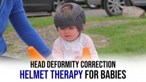 Helmet Therapy